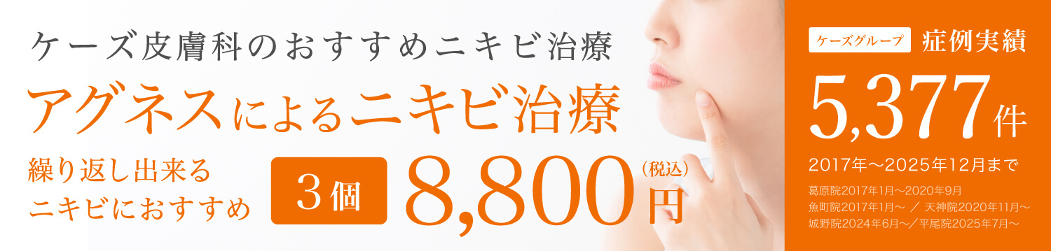 アグネスによるニキビ治療