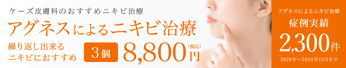 アグネスによるニキビ治療