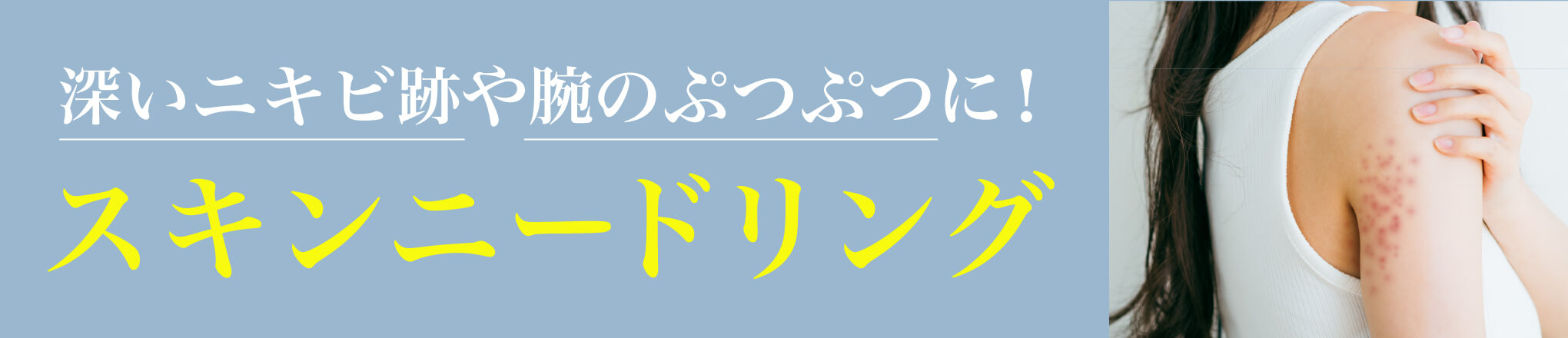スキンニードリング