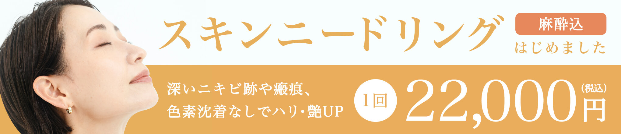 スキンニードリング