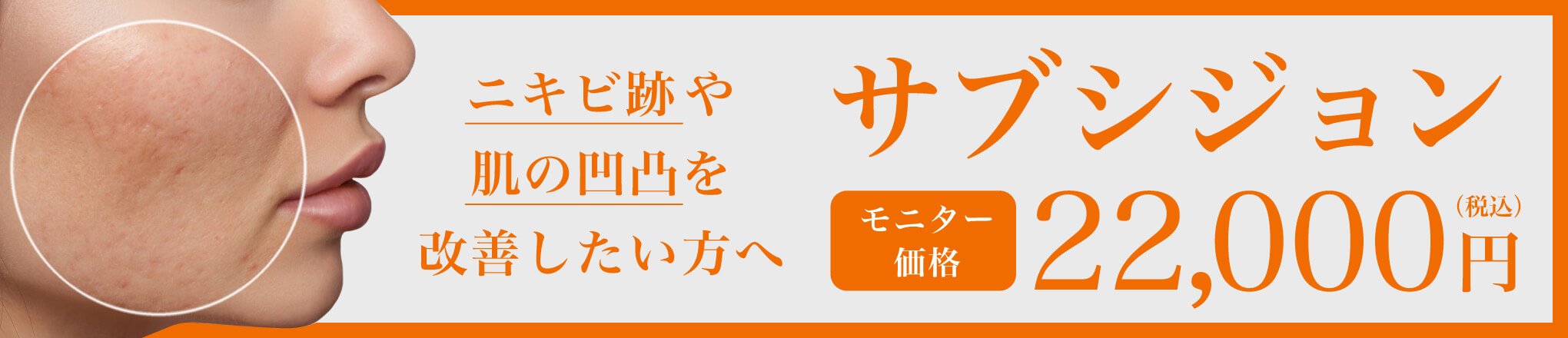 サブシジョンモニター