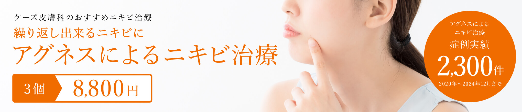 アグネスによるニキビ治療