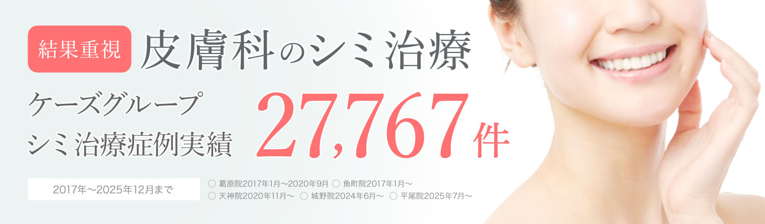 福岡天神のシミ取りレーザー治療はケーズ皮膚科 天神院